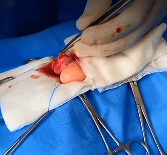 عمل جراحی مثانه گربه